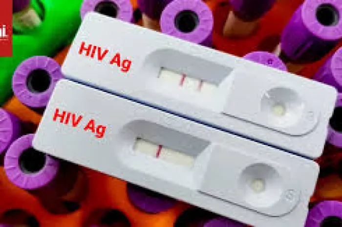 30 Orang Peserta Pesta Gay di Puncak Bogor Dinyatakan Reaktif HIV-Sifilis